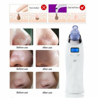Вакуум уред за почистване на лицето в домашни условия - модел с дисплей